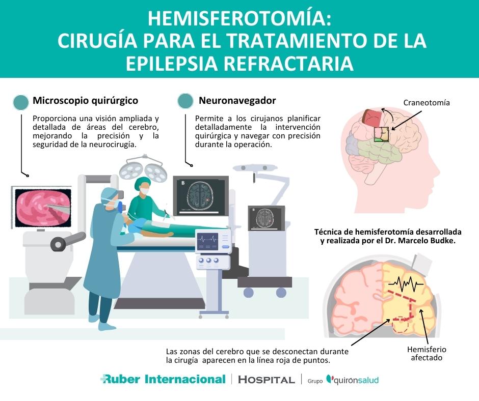 hemisferotomia cirugia epilepsia doctor Budke