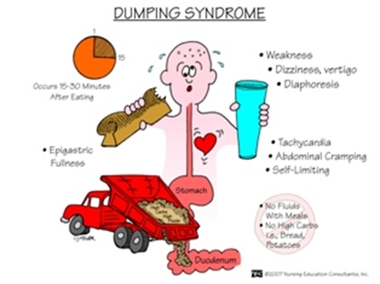 Síndrome dumping