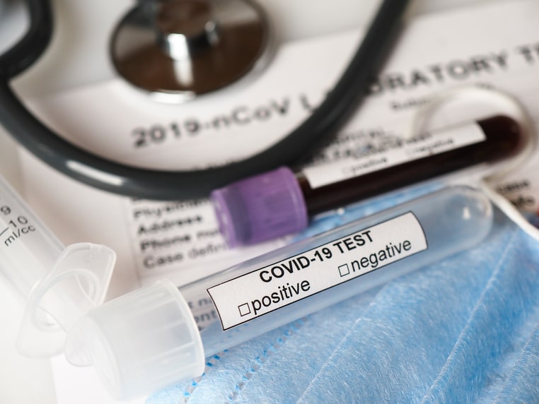 coronavirus-covid-2019-test-concept-2021-08-27-15-12-13-utc (1)-min