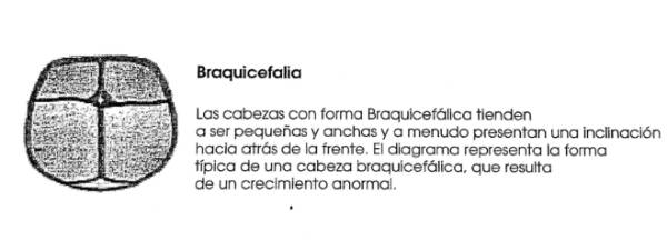 braquicefalia
