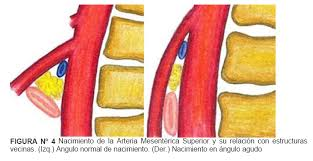 arteria mesentérica