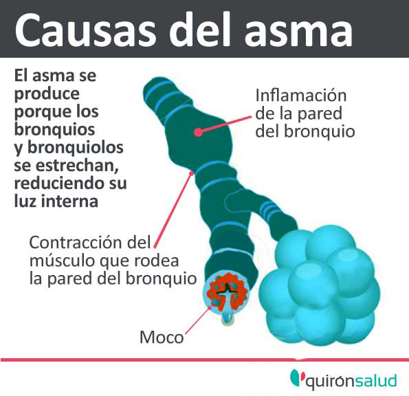 causas_del_asma