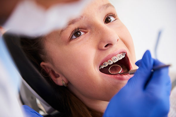 ¿Qué es la ortodoncia infantil?