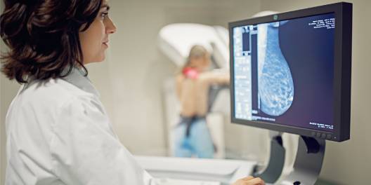 Beca en Radiología mamaria Quirónsalud