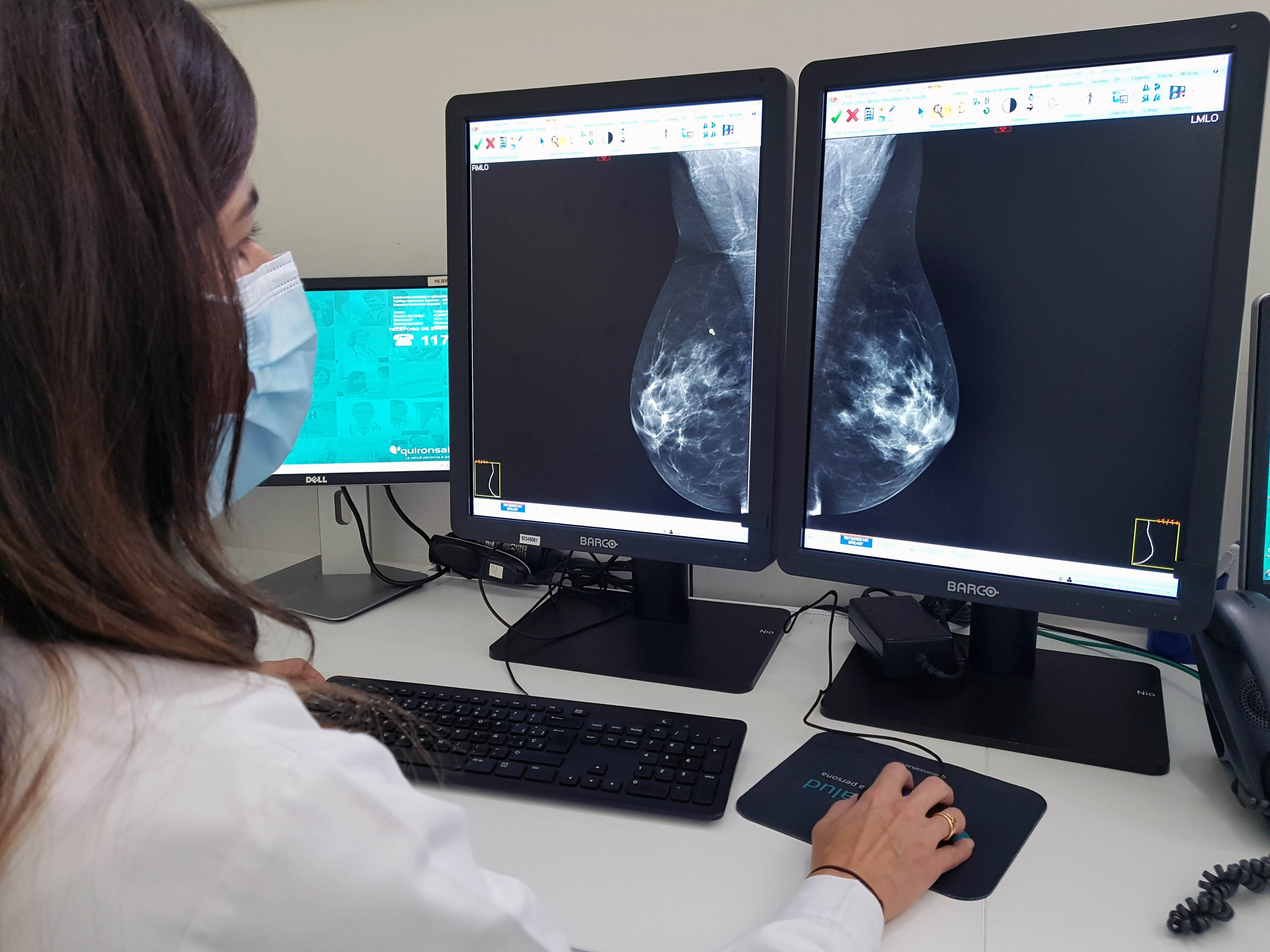 mamografía_quirónsalud_campodegibraltar
