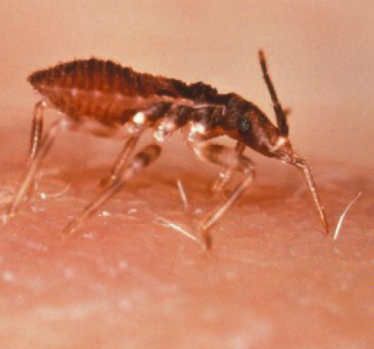 Enfermedad de Chagas - picadura de insecto hemíptero