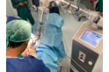 Blefaroplastia sin cirugía - Dr. Salvador Molina - Oftalmología 2