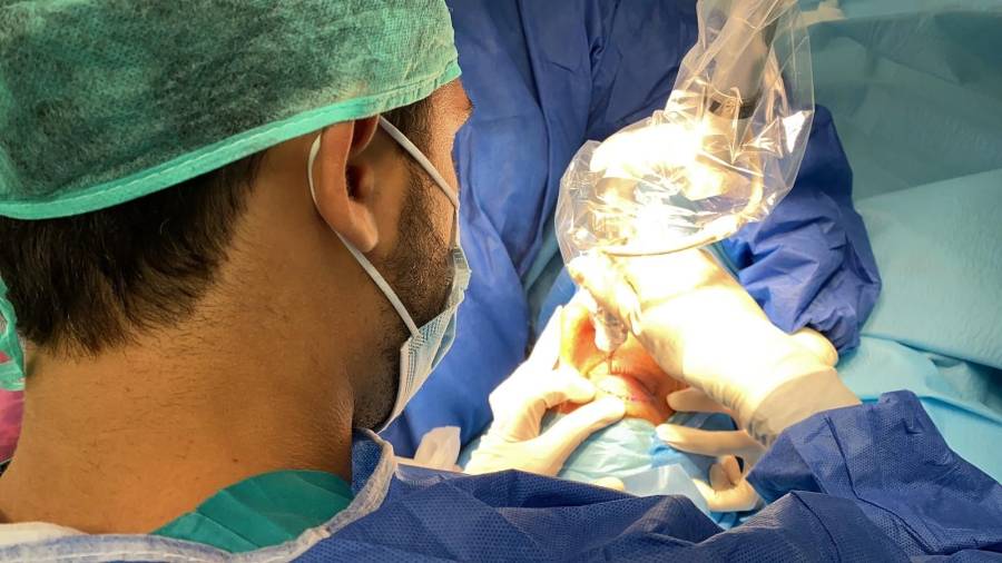 Blefaroplastia sin cirugía - Dr. Salvador Molina - Oftalmología 3
