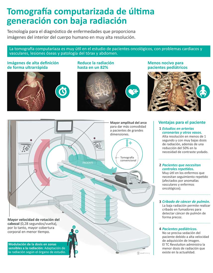 infografia_tomografia_computarizada_baja_radiacion