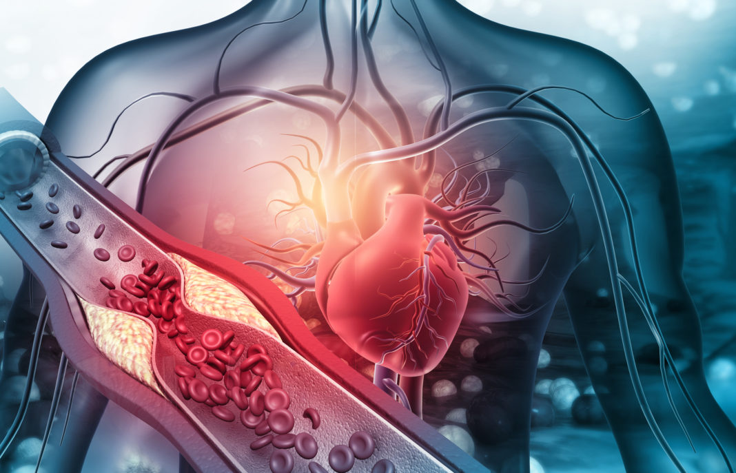 cardiologia intervencionista hemodinamia murcia quironsalud (2)