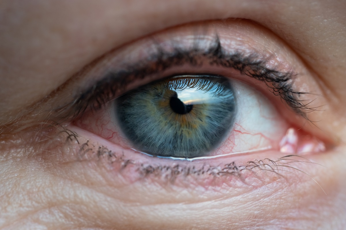 como ve una persona con glaucoma murcia