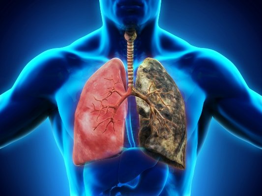 Pulmón sano y pulmón de fumador