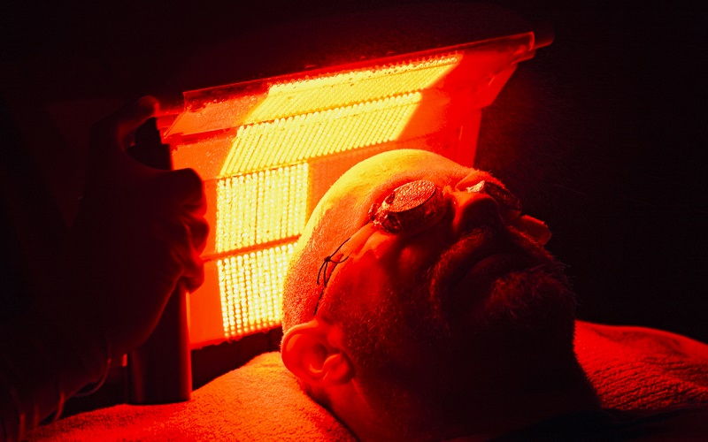 Cómo actúa la terapia fotodinámica en el cáncer de piel