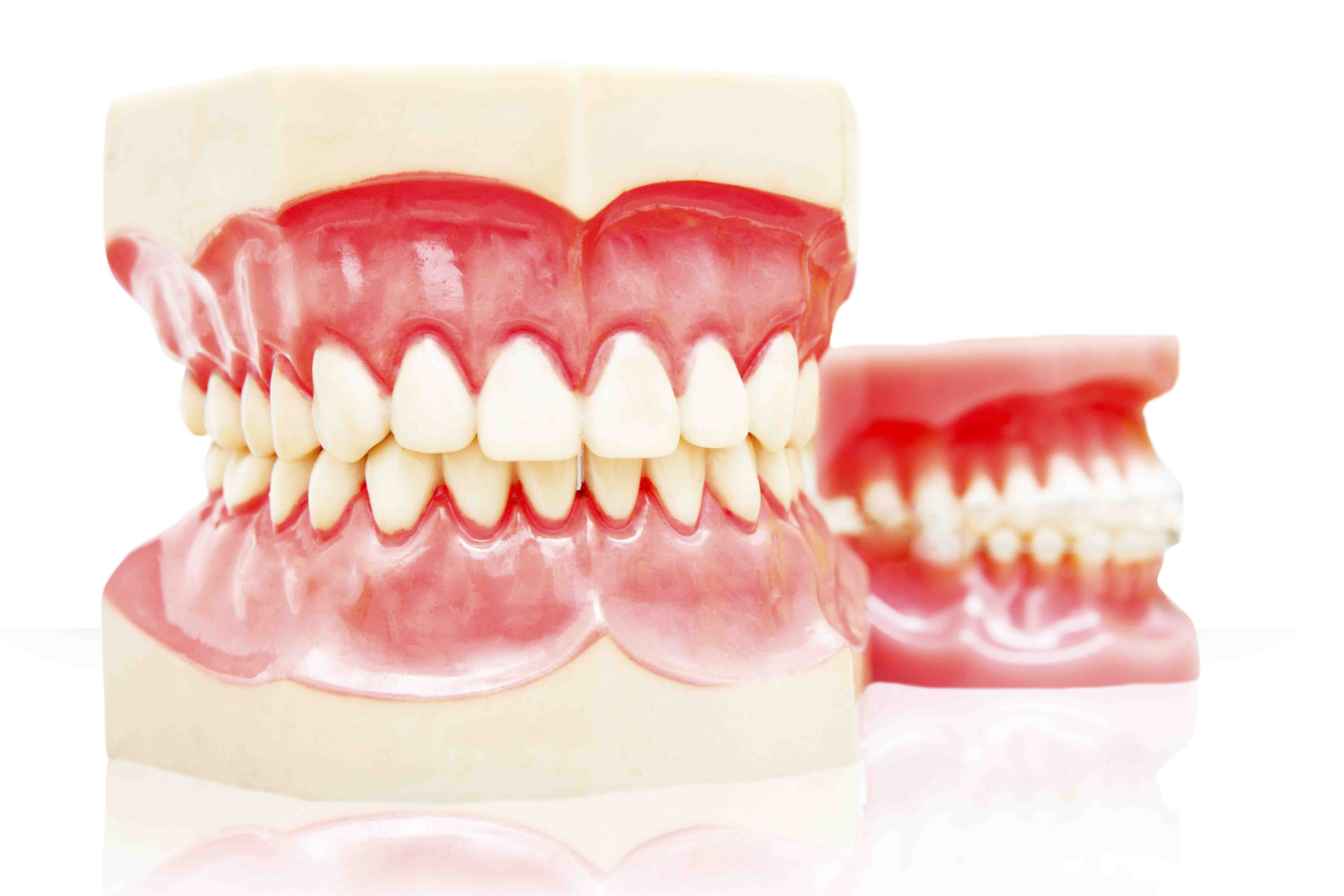 Las prótesis removibles, comodidad para pacientes que necesitan prótesis dentales Blogs