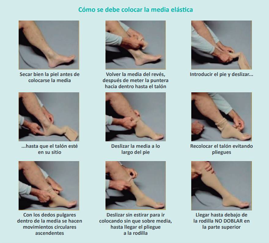 Recomendaciones para el uso de medias de compresión elástica | Hospital  Universitario Quirónsalud Madrid