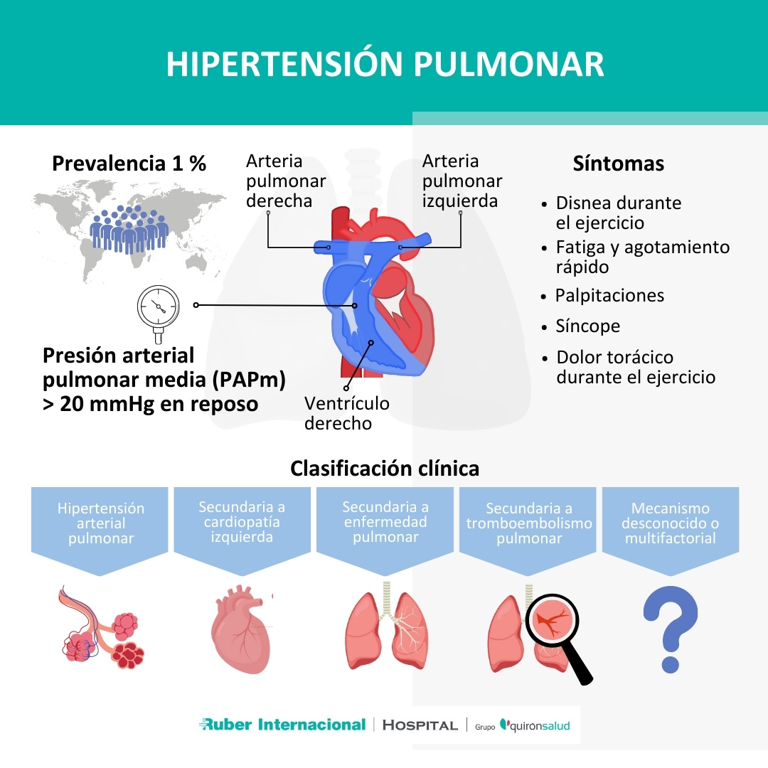 Hipertensión Pulmonar
