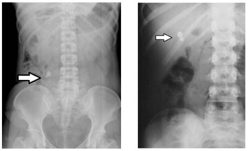fig5-Imagenes-de-radiografia-simple-de-abdomen