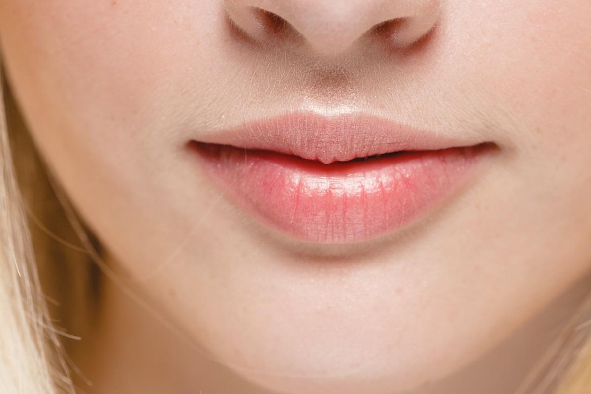 aumento labios valencia acido hialuronico